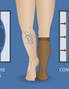 Different Types of Compression Stocking